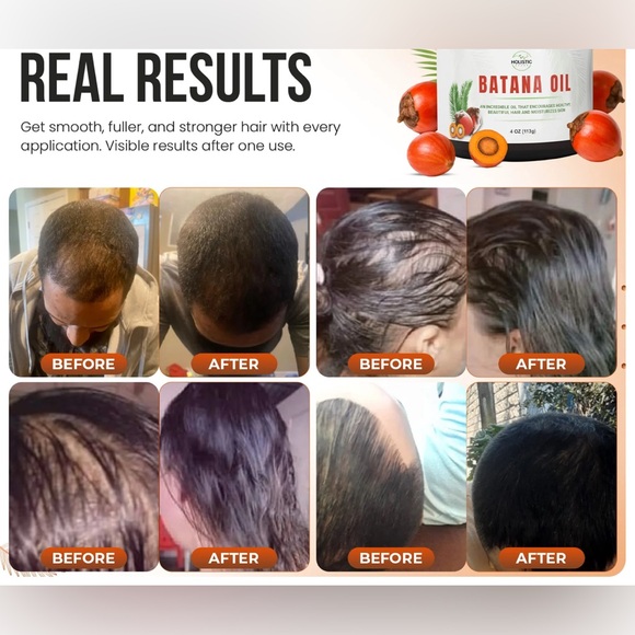 100% BATANA OIL- Hair Conditioner - Silver - Picture 2 of 2